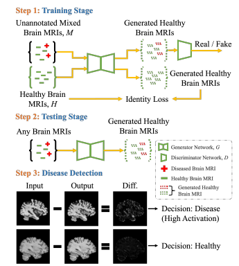 Brainomaly: Unsupervised Neurologic Disease Detection Utilizing Unannotated T1-weighted Brain MR Images