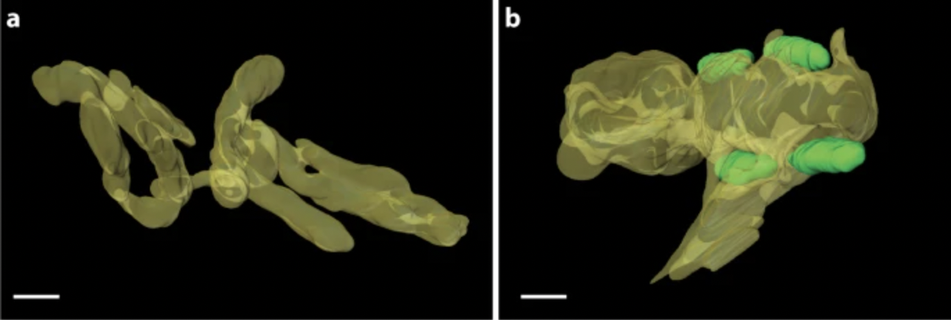Three-Dimensional images reveal the impact of the endosymbiont Midichloria mitochondrii on the host mitochondria